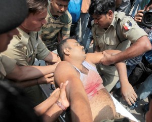 An injured BSF jawan being admitted to GMC Jammu on Wednesday. —Excelsior/Rakesh