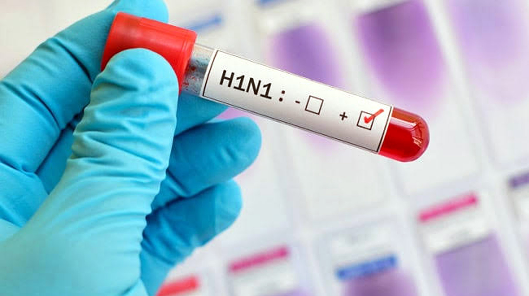 H1n1 Test Results